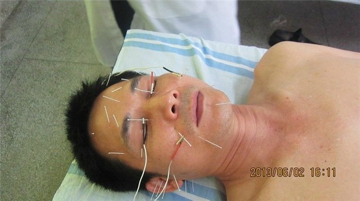 想知道 中医针灸推拿培训多久可以拿培训证?