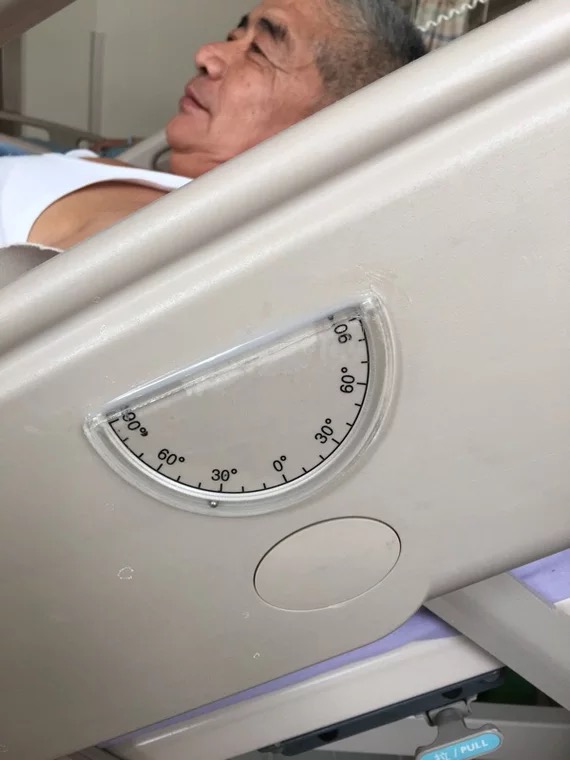 简易床头角度显示卡的使用方法:将床头显示卡固定于床头,需要调整患者